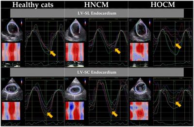 Comparative study of myocardial function in cases of feline hypertrophic cardiomyopathy with and without dynamic left-ventricular outflow-tract obstruction